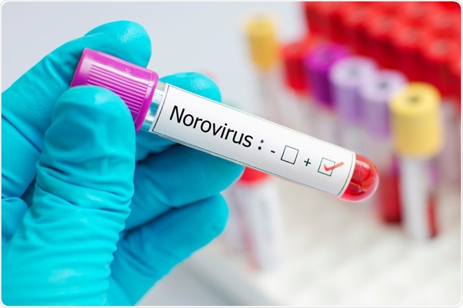 नोरोवायरस (Norovirus) क्या है? – UPSC